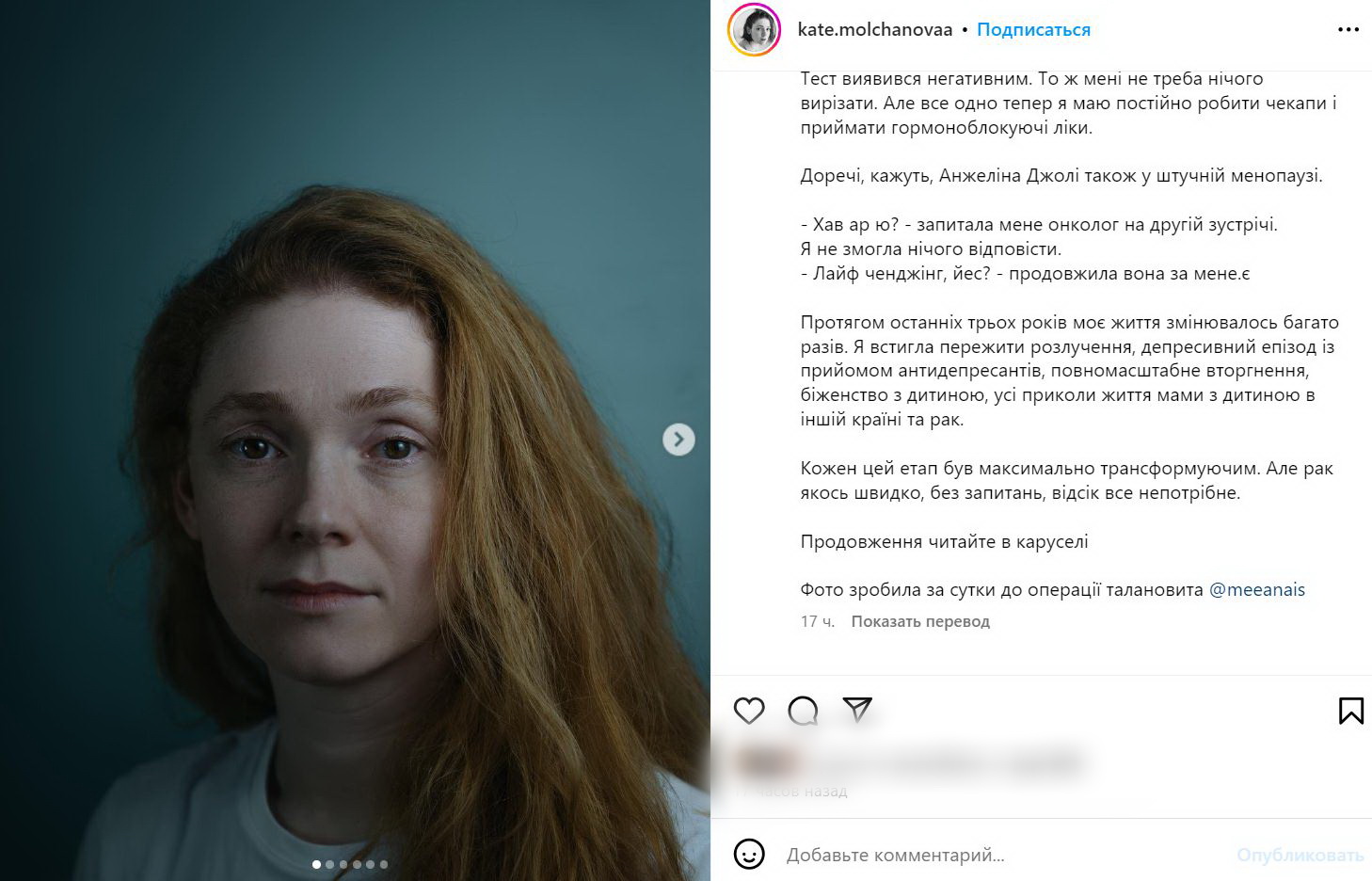 Известной украинской актрисе диагностировали рак — фото