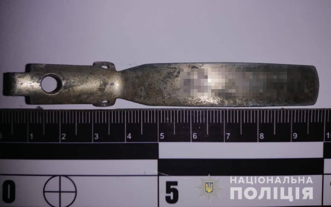 На Одесчине подростку взрывом гранаты оторвало руку (фото) — фото 4