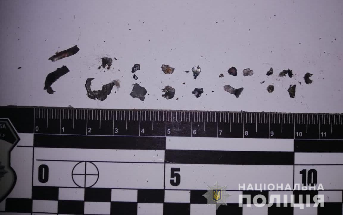 На Одесчине подростку взрывом гранаты оторвало руку (фото) — фото 3