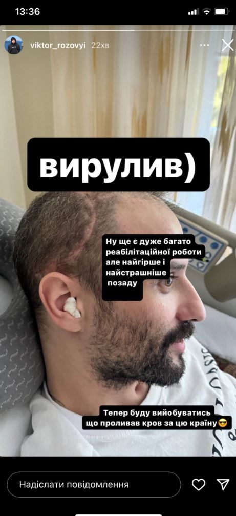 Віктор Розовий з ”Ліги сміху” показав гігантський шрам після поранення в голову — фото 1