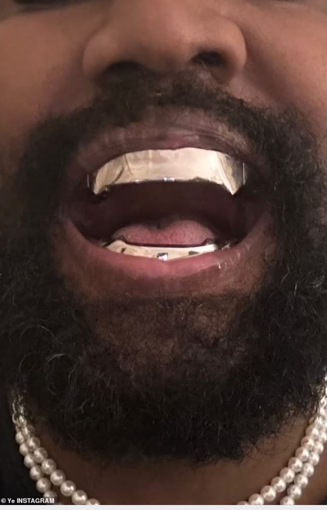 Каньє Вест видалив собі зуби, щоб вставити титанові протези — фото