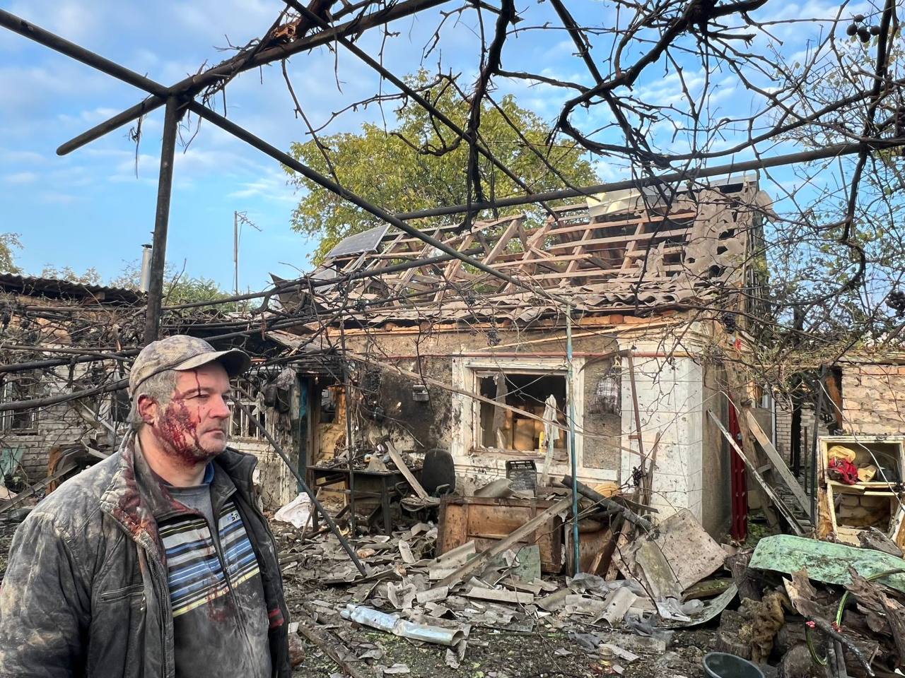 Две женщины погибли в результате российского обстрела Херсона (фото) — фото 1